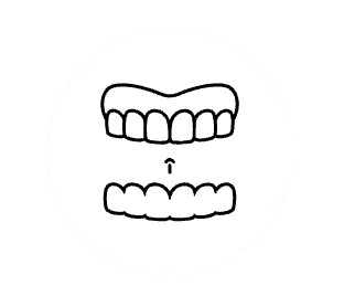 Invisalign